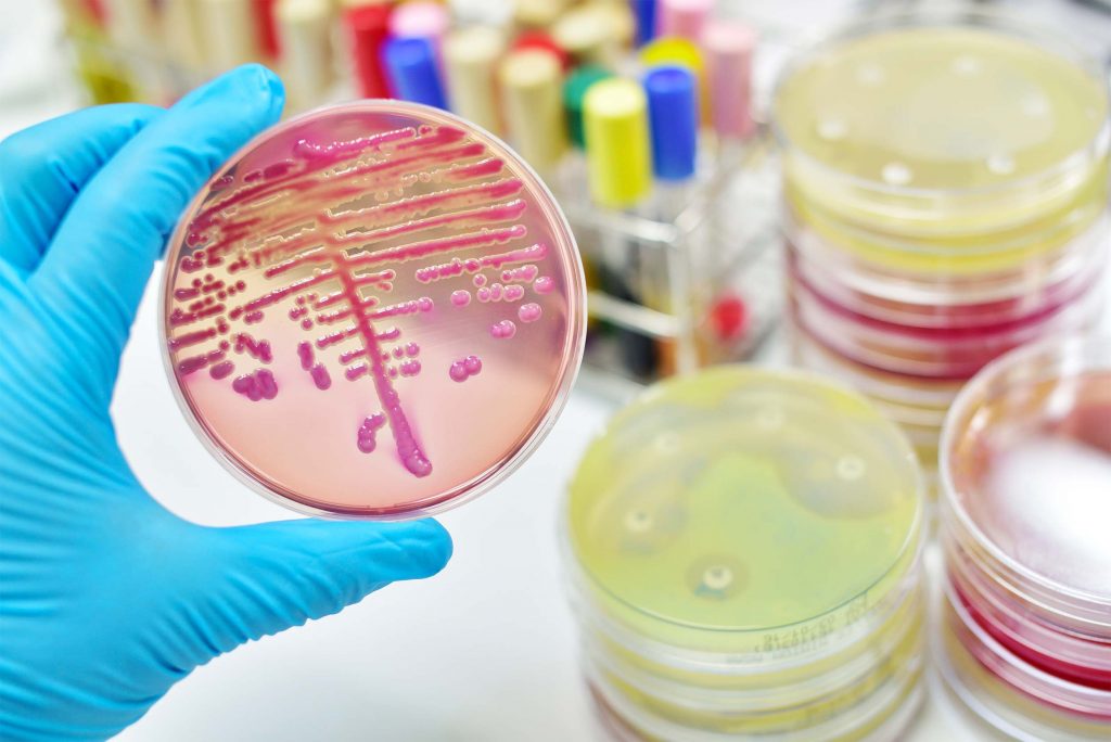 Un estudio aborda la función de las bacterias intestinales para desarrollar nuevos probióticos