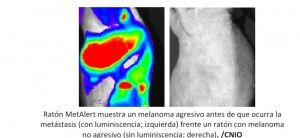 Investigadores del CNIO logran visualizar las metástasis del melanoma antes de que ocurran e identifican nuevas dianas para su tratamiento