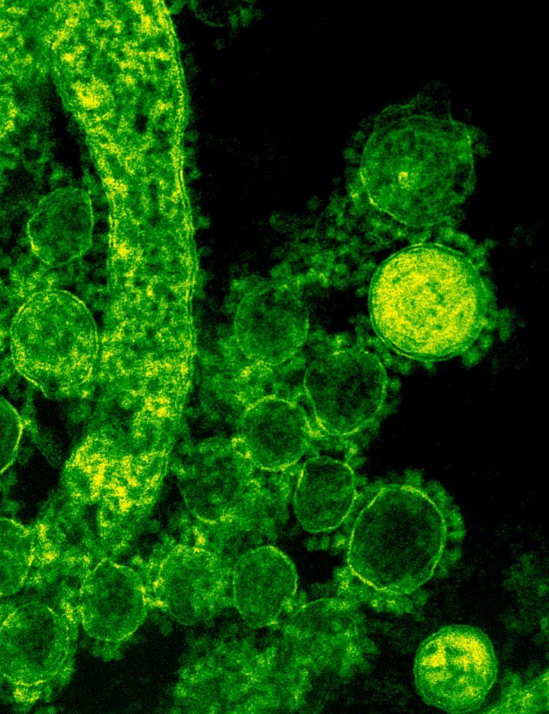 Un equipo del CSIC busca la producción ultrarrápida de anticuerpos neutralizantes contra el coronavirus