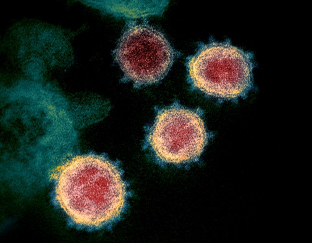 Un estudio muestra cómo el fármaco plitidepsina inhibe la reproducción del SARS-CoV-2 dentro de las células