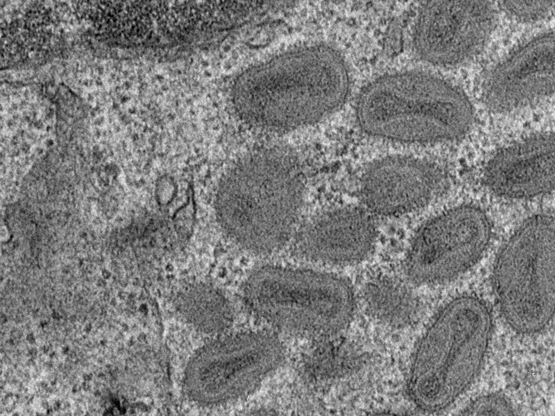 Científicos identifican una proteína clave en la entrada de los poxvirus a las células